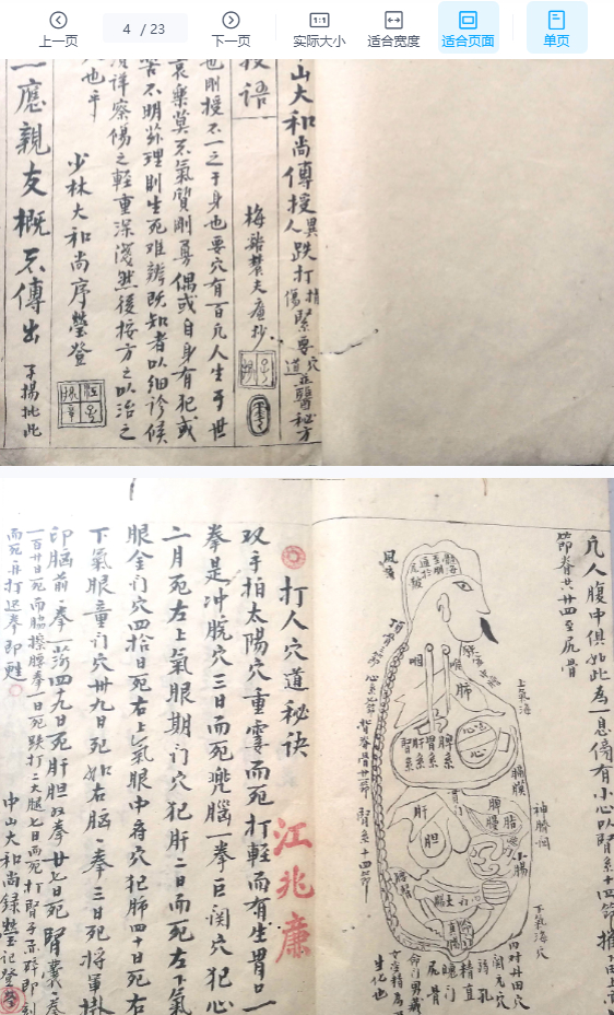 2509154 古籍少林中山大和尚传授《遗传外科》抄本23双面Y插图1