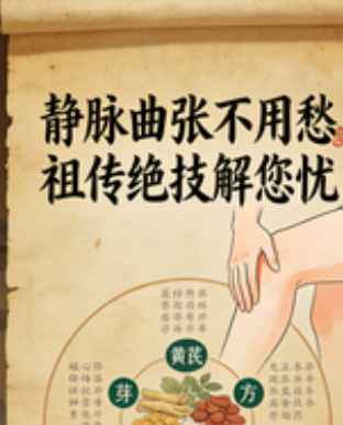 2512240 祖传临床绝技：静脉曲张（静脉一抹平）